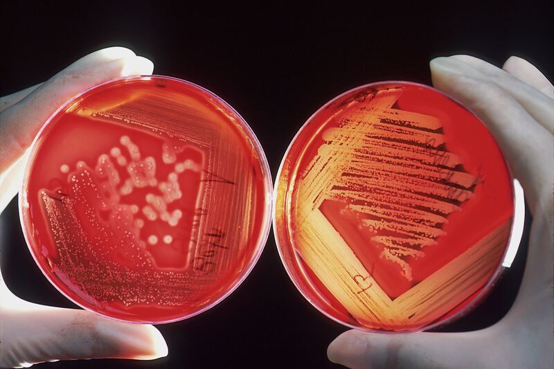 A pair of hands holding red petri dishes