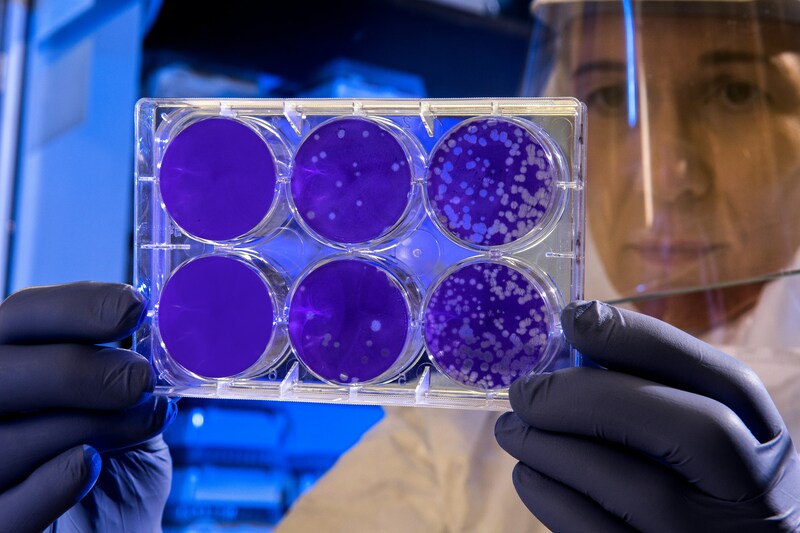 Woman holding petri dishes