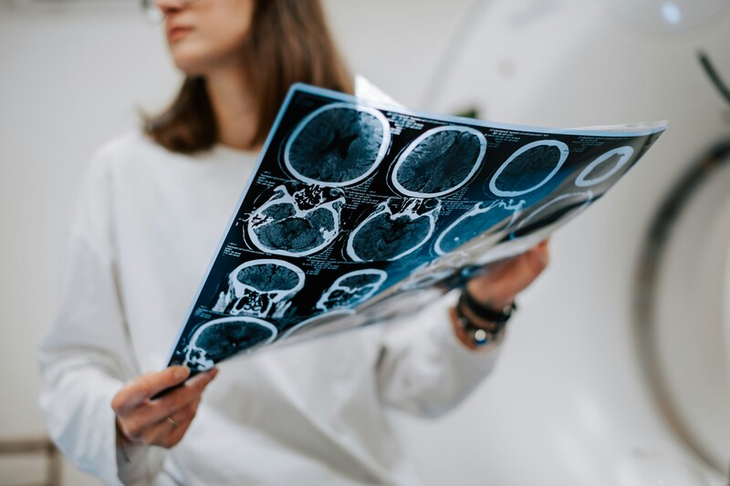 Woman holding ct scan